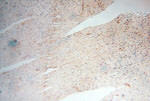 HLA class I (HLA-B) Antibody in Immunohistochemistry (Paraffin) (IHC (P))