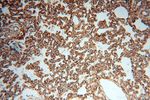 HLA class I (HLA-B) Antibody in Immunohistochemistry (Paraffin) (IHC (P))