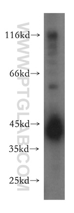 HLA class I (HLA-B) Antibody in Western Blot (WB)