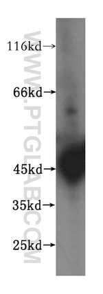 HLA class I (HLA-B) Antibody in Western Blot (WB)