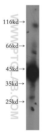 HLA class I (HLA-B) Antibody in Western Blot (WB)