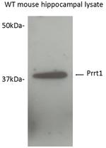 SynDIG4/PRRT1 Antibody in Western Blot (WB)