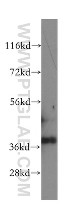 GPD1L Antibody in Western Blot (WB)