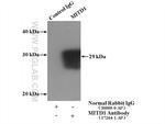 MITD1 Antibody in Immunoprecipitation (IP)