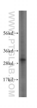 MITD1 Antibody in Western Blot (WB)