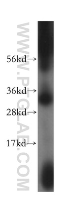 MITD1 Antibody in Western Blot (WB)