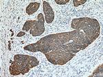 Cytokeratin 16 Antibody in Immunohistochemistry (Paraffin) (IHC (P))