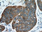 Cytokeratin 16 Antibody in Immunohistochemistry (Paraffin) (IHC (P))