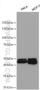 Cytokeratin 16 Antibody in Western Blot (WB)