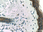 Cytokeratin 16 Antibody in Immunohistochemistry (Paraffin) (IHC (P))