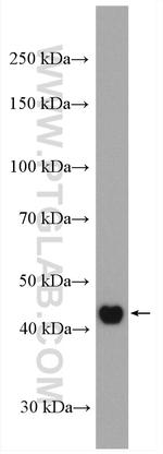 Cytokeratin 16 Antibody in Western Blot (WB)