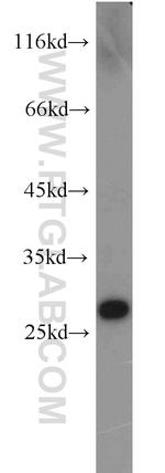 GSTA4 Antibody in Western Blot (WB)