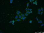 SNAPC5 Antibody in Immunocytochemistry (ICC/IF)