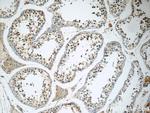 SNAPC5 Antibody in Immunohistochemistry (Paraffin) (IHC (P))