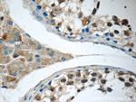 SNAPC5 Antibody in Immunohistochemistry (Paraffin) (IHC (P))