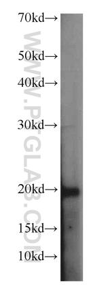 SNAPC5 Antibody in Western Blot (WB)