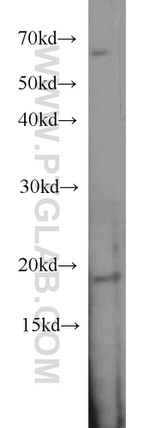 SNAPC5 Antibody in Western Blot (WB)