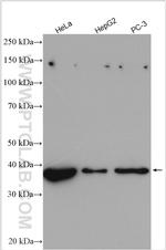 LARP2 Antibody in Western Blot (WB)