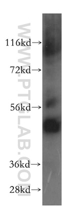 MRPS27 Antibody in Western Blot (WB)