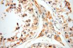 UBE2DNL Antibody in Immunohistochemistry (Paraffin) (IHC (P))