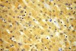 KIF6 Antibody in Immunohistochemistry (Paraffin) (IHC (P))