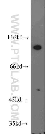 KIF6 Antibody in Western Blot (WB)