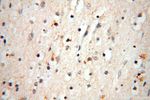 HSD17B11 Antibody in Immunohistochemistry (Paraffin) (IHC (P))