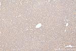 ERLIN1 Antibody in Immunohistochemistry (Paraffin) (IHC (P))