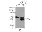 ERLIN1 Antibody in Immunoprecipitation (IP)