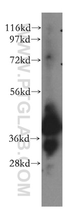 ERLIN1 Antibody in Western Blot (WB)