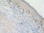 CD1a Antibody in Immunohistochemistry (Paraffin) (IHC (P))