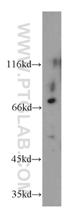CD1a Antibody in Western Blot (WB)