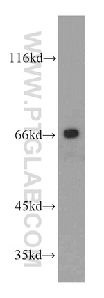 CD1a Antibody in Western Blot (WB)