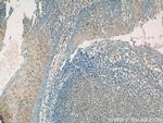 GSG1L Antibody in Immunohistochemistry (Paraffin) (IHC (P))