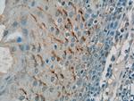 GSG1L Antibody in Immunohistochemistry (Paraffin) (IHC (P))