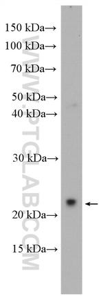 GSG1L Antibody in Western Blot (WB)