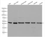 GSG1L Antibody in Western Blot (WB)