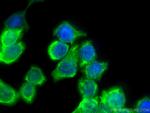 Cytokeratin 20 Antibody in Immunocytochemistry (ICC/IF)