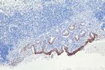 Cytokeratin 20 Antibody in Immunohistochemistry (Paraffin) (IHC (P))