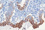 Cytokeratin 20 Antibody in Immunohistochemistry (Paraffin) (IHC (P))