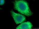 Cytokeratin 20 Antibody in Immunocytochemistry (ICC/IF)