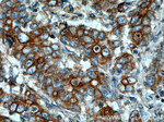 Cytokeratin 20 Antibody in Immunohistochemistry (Paraffin) (IHC (P))