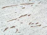 Cytokeratin 20 Antibody in Immunohistochemistry (Paraffin) (IHC (P))