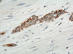 Cytokeratin 20 Antibody in Immunohistochemistry (Paraffin) (IHC (P))