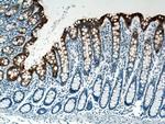 Cytokeratin 20 Antibody in Immunohistochemistry (Paraffin) (IHC (P))