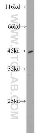 Pepsinogen I Antibody in Western Blot (WB)