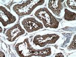 LIPE Antibody in Immunohistochemistry (Paraffin) (IHC (P))