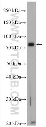 LIPE Antibody in Western Blot (WB)