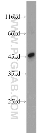 MEK4 Antibody in Western Blot (WB)