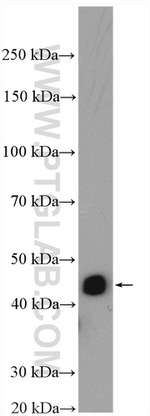 MEK4 Antibody in Western Blot (WB)